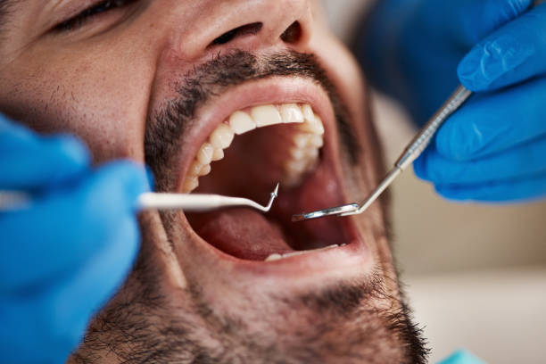Best Emergency Dental Care for Sports Injuries in Merrill, WI