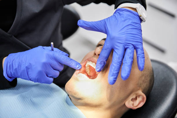 Best Broken or Chipped Tooth Repair in Merrill, WI