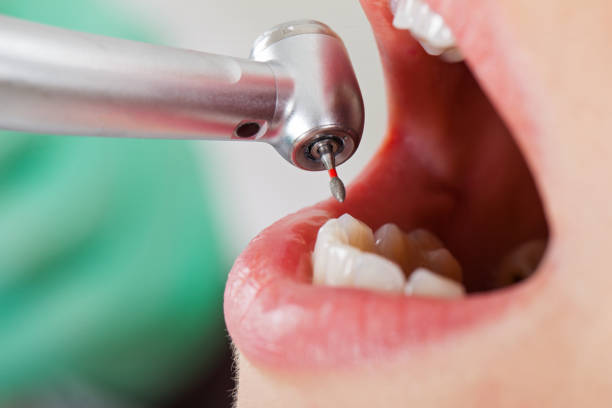 Best Emergency Root Canal Therapy in Merrill, WI